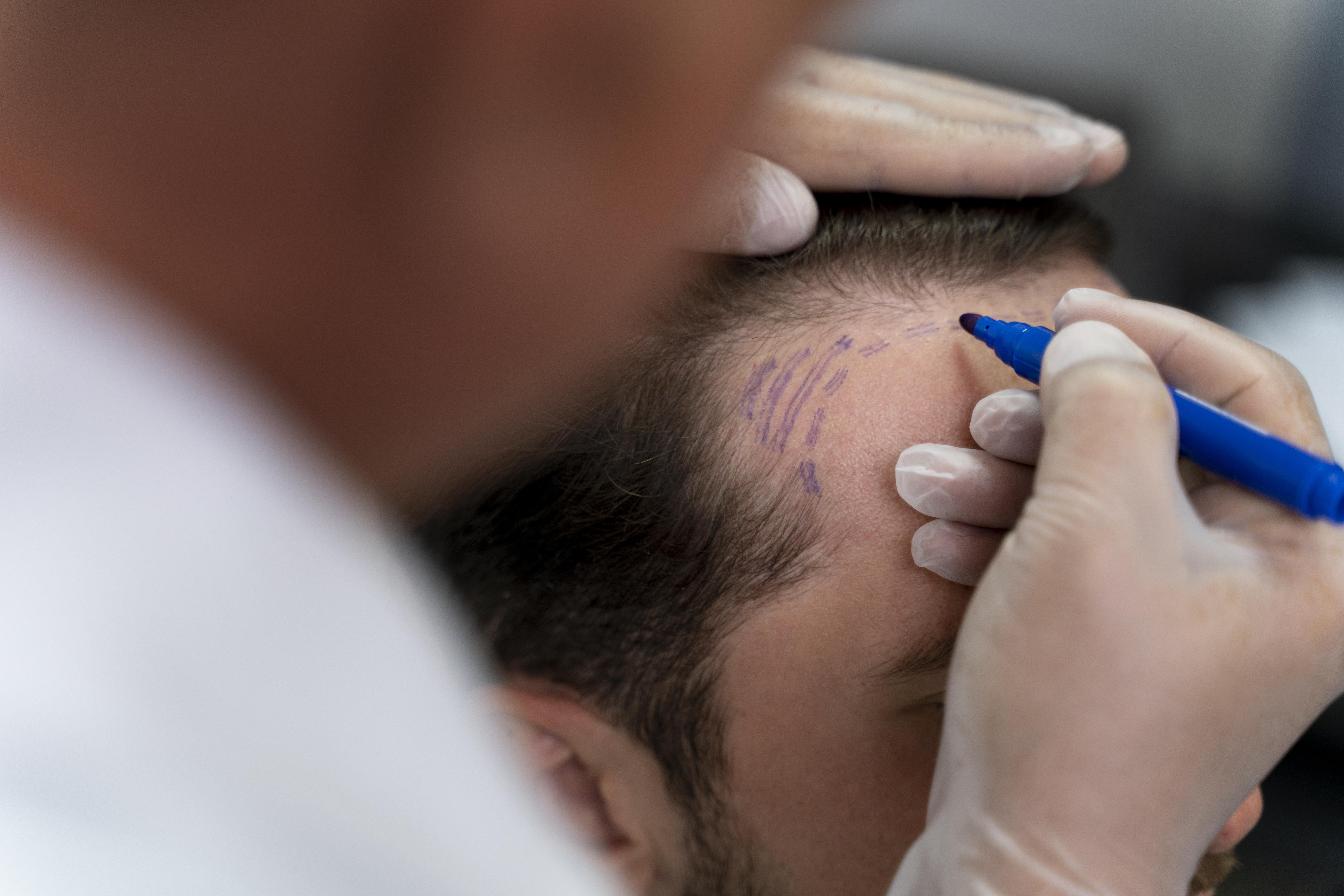 Treatment photo
